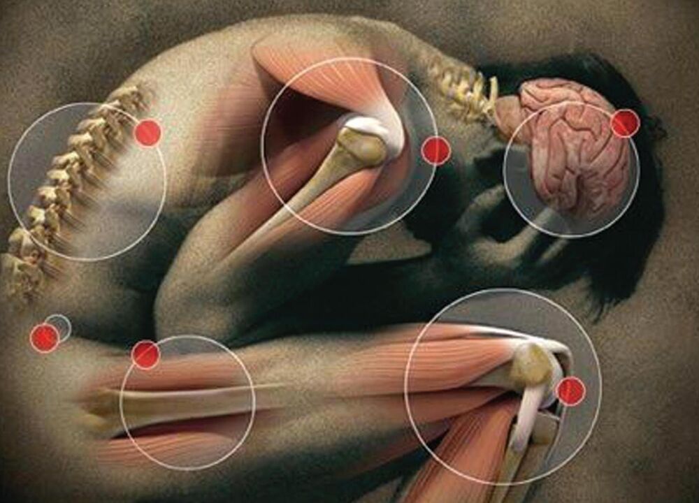 articulações do corpo afetadas pela artrose