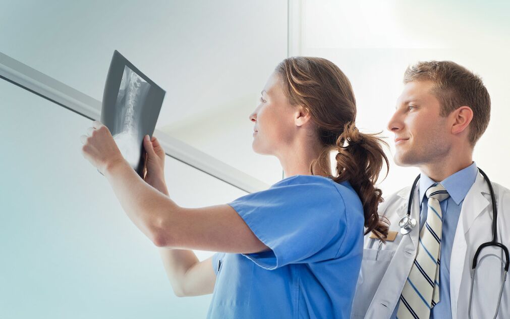 médicos olhando para um raio-x para artrose
